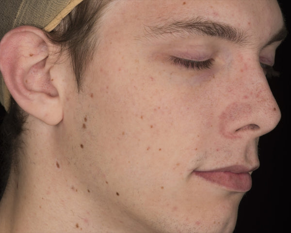 Male Face 20s FullFace #17 - Texturing.xyz