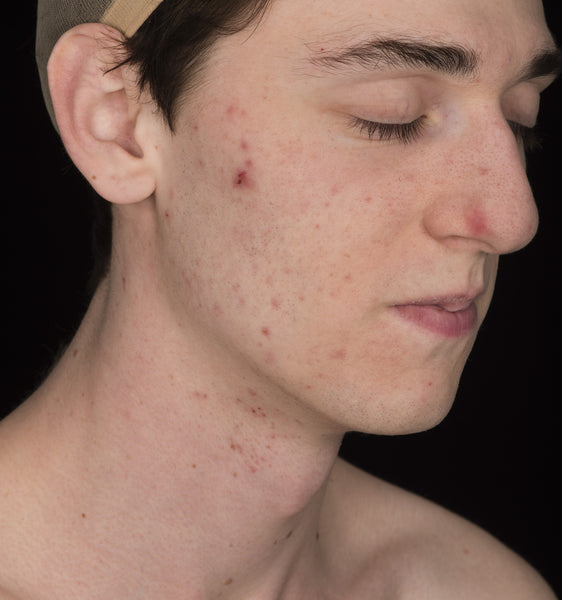 Male Face 20s FullFace #40 - Texturing.xyz