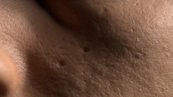 Male 20s Multichannel Face #50 - Texturing.xyz