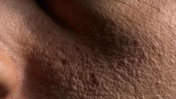 Female 30s Multichannel Face #69 - Texturing.xyz