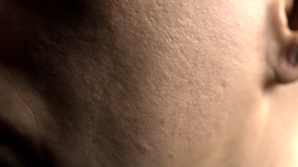 Female 30s Multichannel Face #44 - Texturing.xyz
