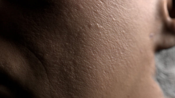 Male 20s Multichannel Face #34 - Texturing.xyz