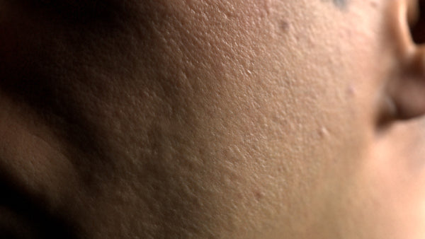 Male 30s Multichannel Face #83 - Texturing.xyz
