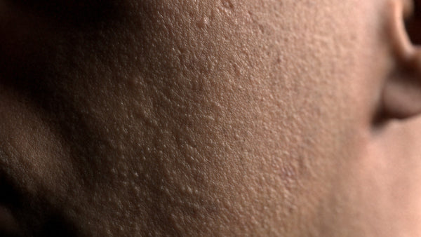 Male 30s Multichannel Face #01 - Texturing.xyz