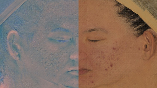 Female 20s Multichannel Face #53 - Texturing.xyz
