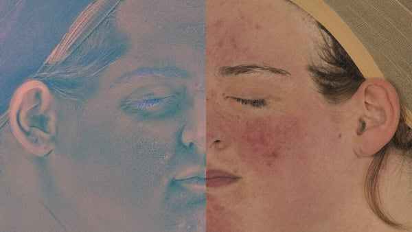 Female 20s Multichannel Face #10 - Texturing.xyz