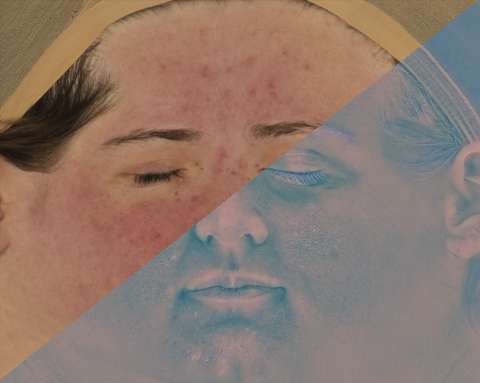 Female 20s Multichannel Face #10 - Texturing.xyz
